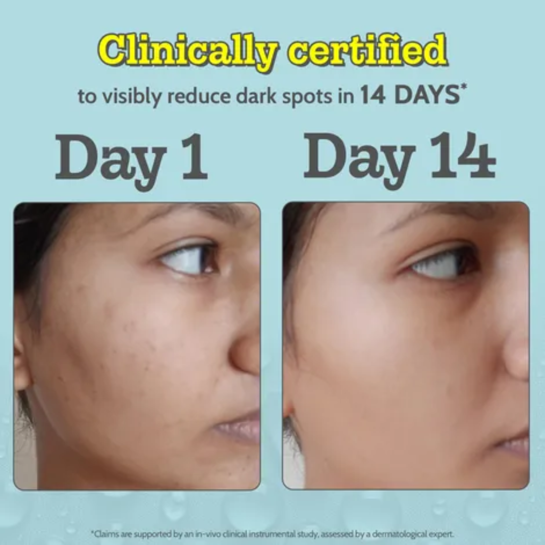 Chemist at play Vitamin C serum - Reduce Ance & dark spots and Brighten skin tone in just 7 days