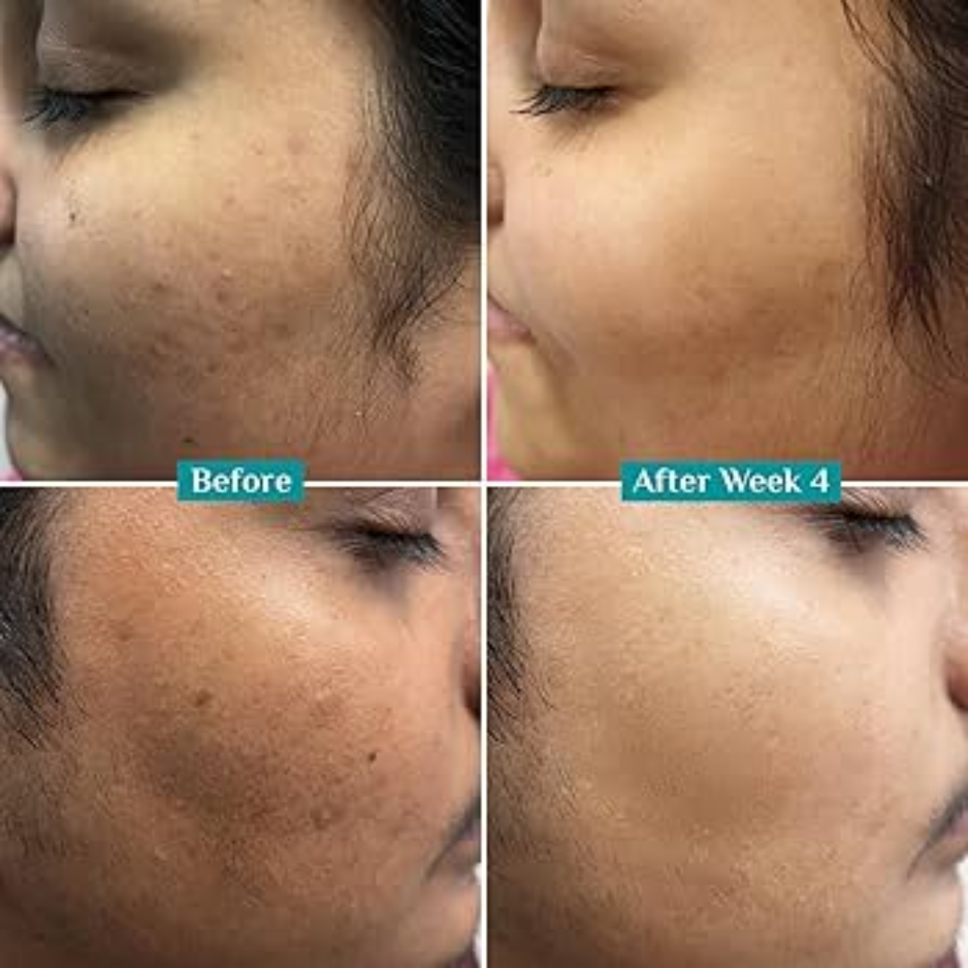 Chemist at play Vitamin C serum - Reduce Ance & dark spots and Brighten skin tone in just 7 days