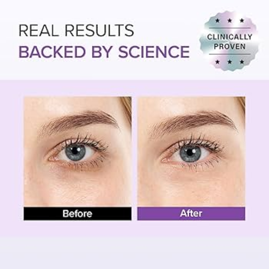 Anti-Wrinkle cream by Mary & May - Reduce dark spots & Fine lines - 2025 Best Cream