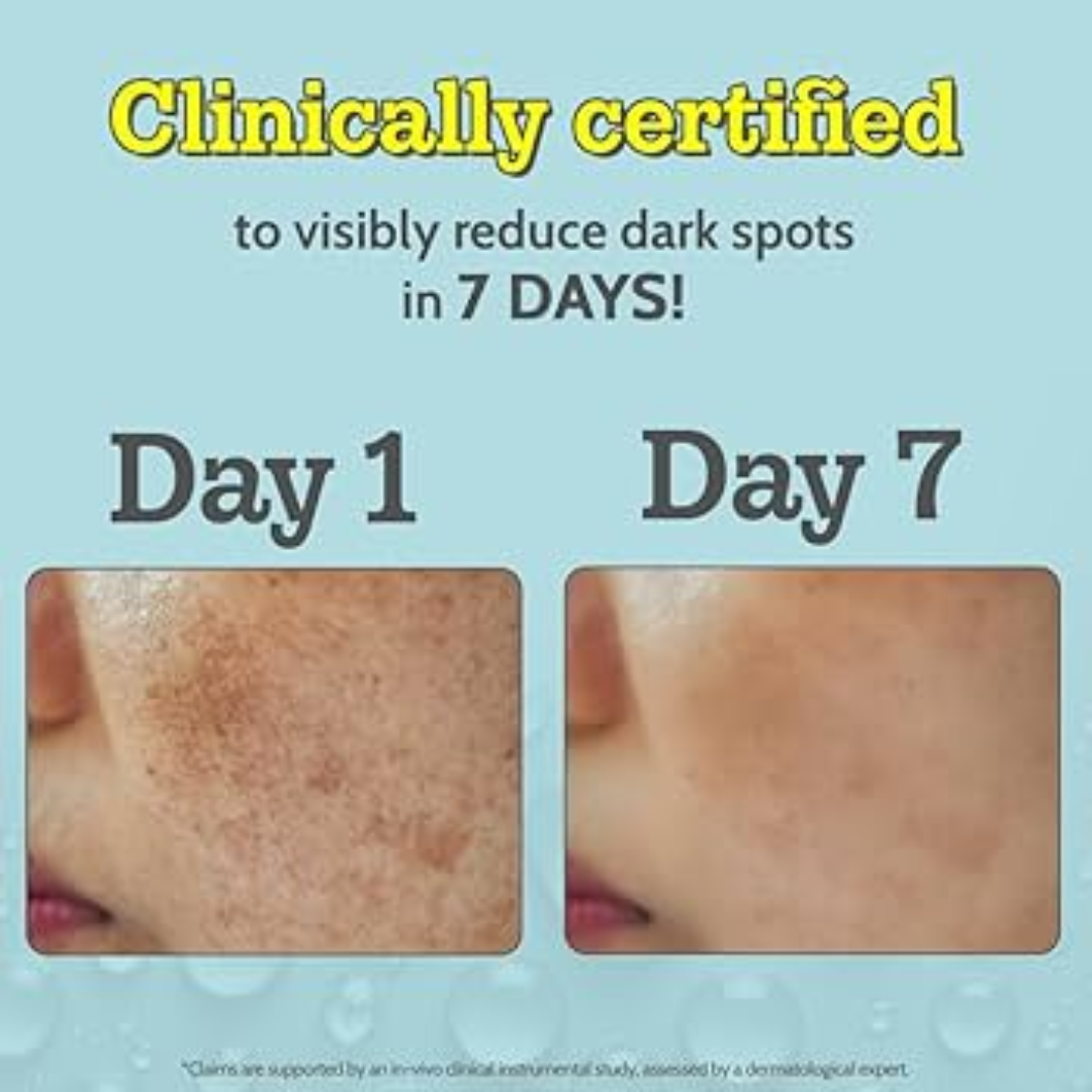 Chemist at play Vitamin C serum - Reduce Ance & dark spots and Brighten skin tone in just 7 days