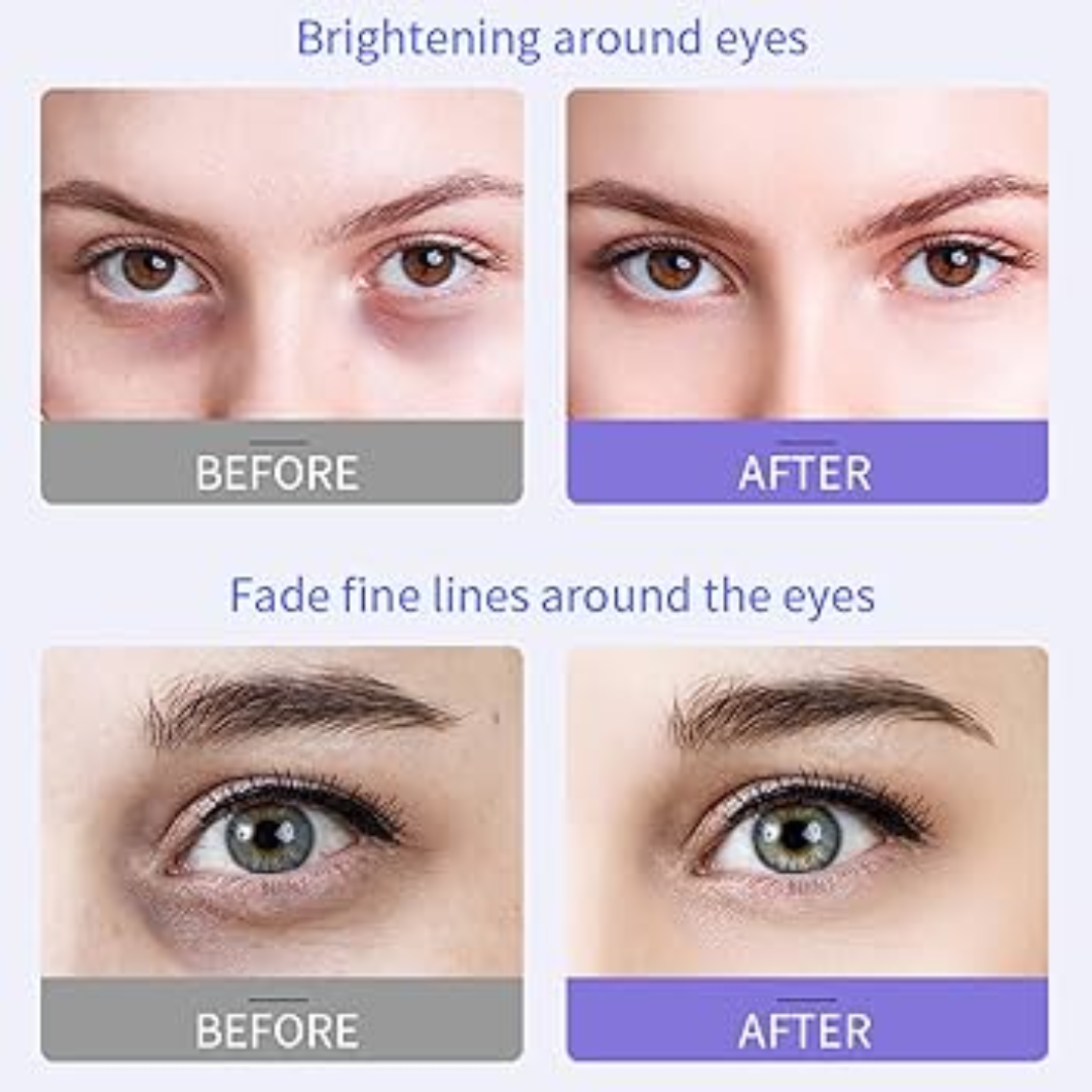 Anti-Wrinkle cream by Mary & May - Reduce dark spots & Fine lines - 2025 Best Cream