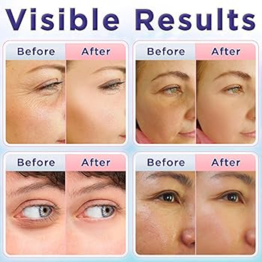 Anti-Wrinkle cream by Mary & May - Reduce dark spots & Fine lines - 2025 Best Cream