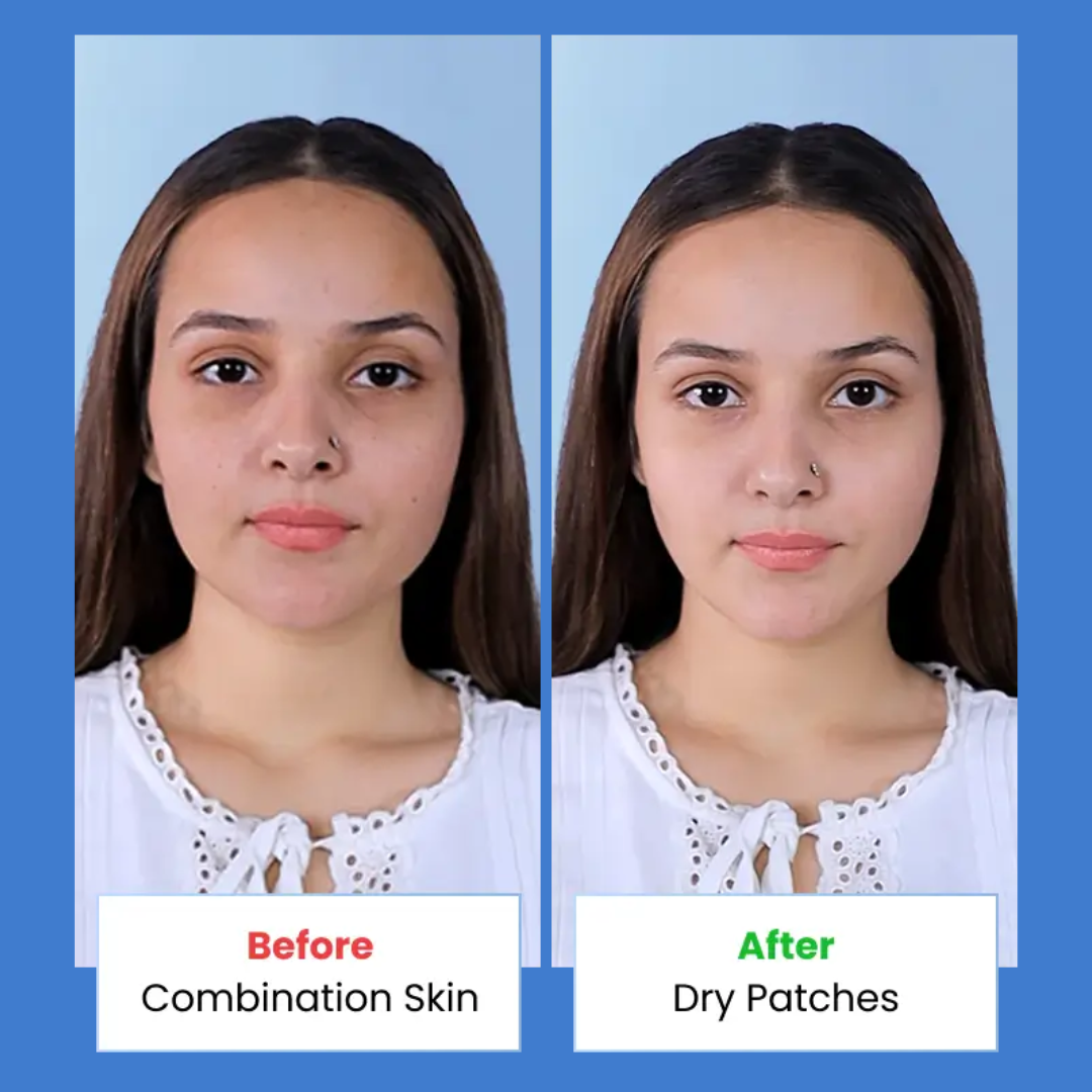 SUROSKIE Radiance Reveal Peel-Off Mask - Instant Youthful Glow & Deep Hydration