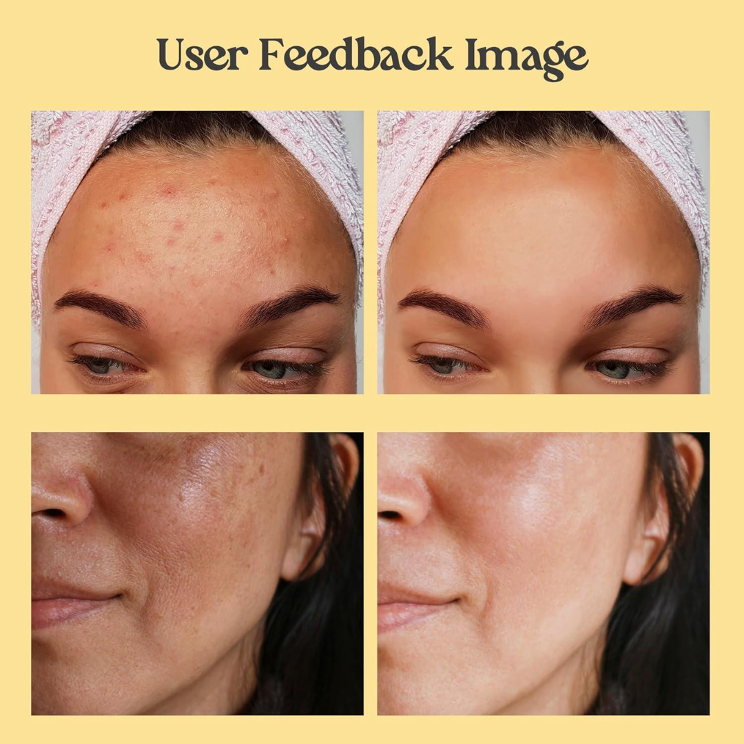 SUROSKIE Radiance Reveal Peel-Off Mask - Instant Youthful Glow & Deep Hydration