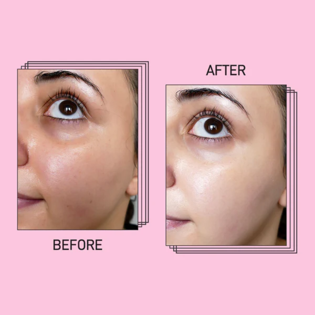 SUROSKIE Radiance Reveal Peel-Off Mask - Instant Youthful Glow & Deep Hydration