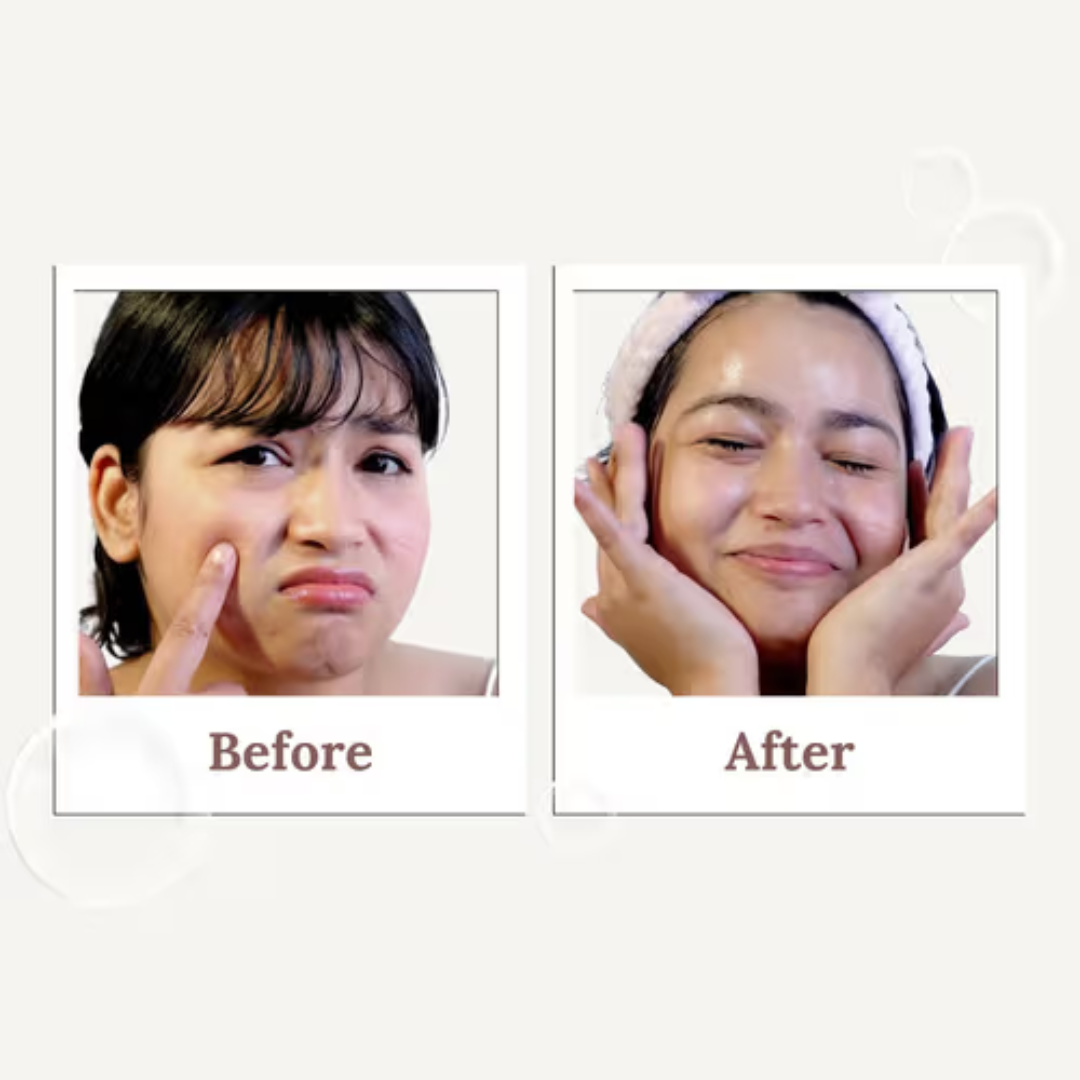 SUROSKIE Radiance Reveal Peel-Off Mask - Instant Youthful Glow & Deep Hydration