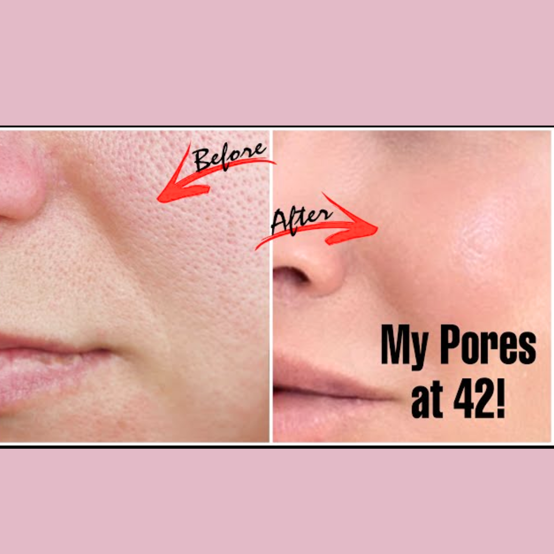 Centella Light Pore-Refining Gel Cream