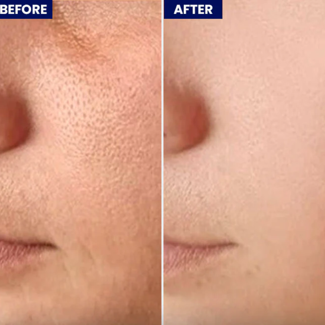 Centella Light Pore-Refining Gel Cream