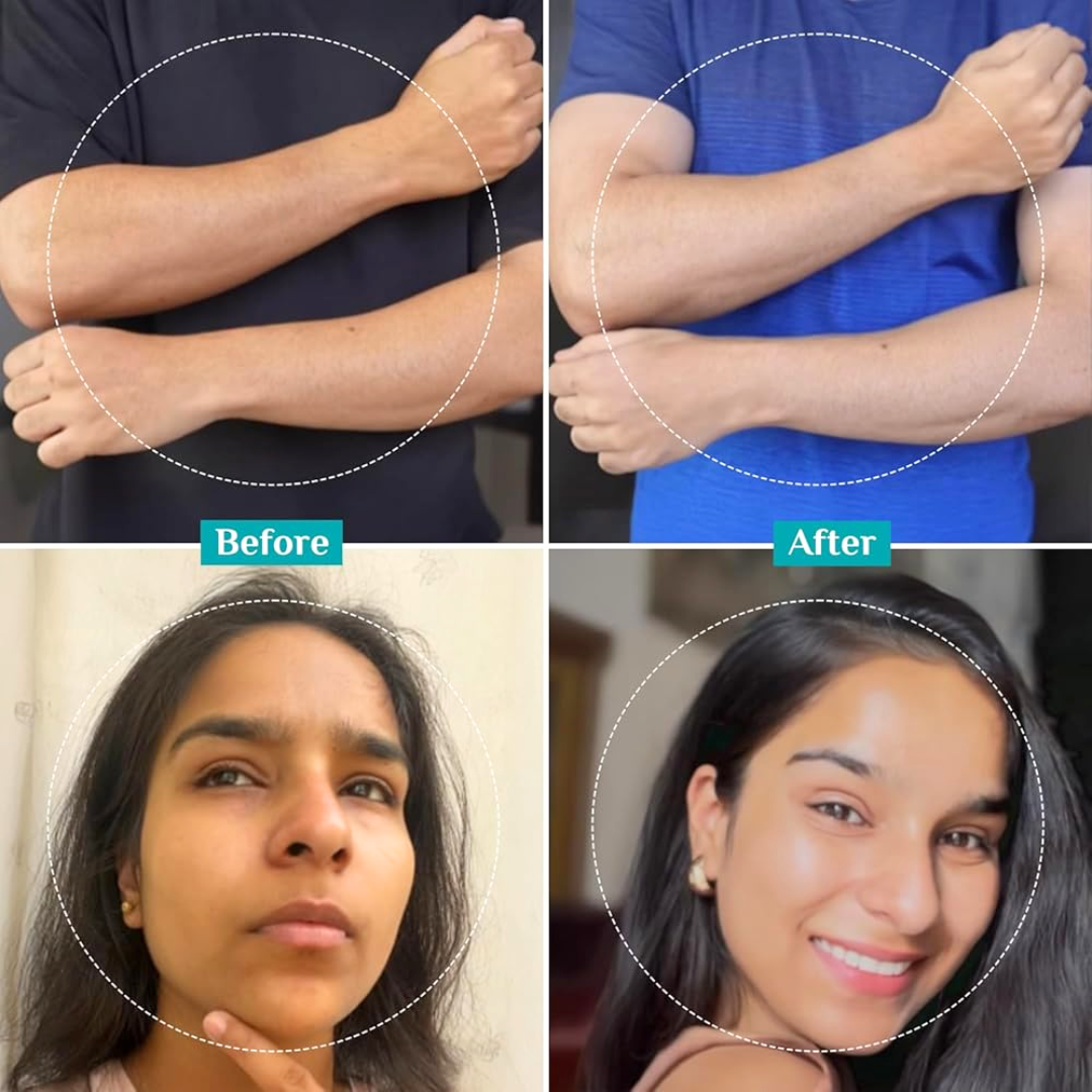 Pilgrim 25% AHA + 2% BHA + 5% PHA Peeling Solution Face Serum for Exfoliation|10 Minutes DeTan Challenge