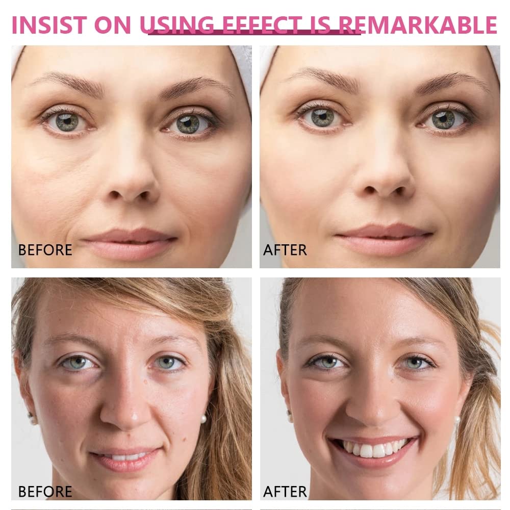 SUROSKIE Radiance Reveal Peel-Off Mask - Instant Youthful Glow & Deep Hydration