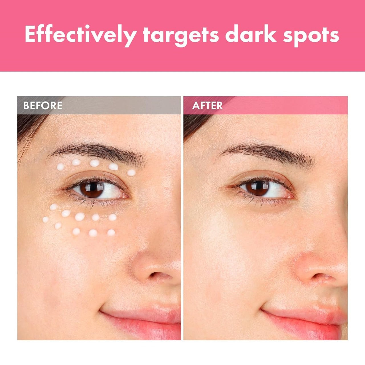 Arbutin Intensive Spot Cream (Remove acne spots & pigmentation + Gives Clear & Bright Skin)